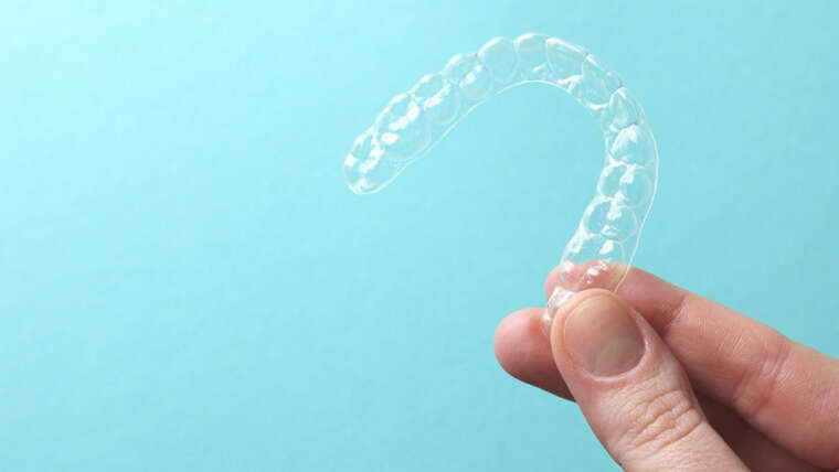 Ortodonzia Invisalign