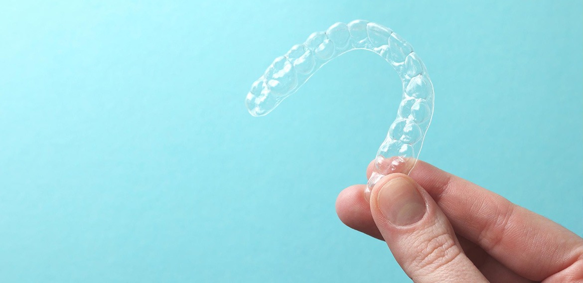 Ortodonzia Invisalign